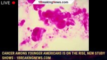 Cancer among younger Americans is on the rise, new study shows - 1breakingnews.com
