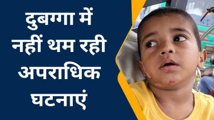 लखनऊ: दुबग्गा में महिला के साथ पर्स लूट की वारदात,सड़क पर गिरकर बच्चा हुआ घायल