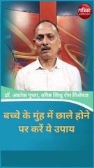बच्चे के मुंह में छाले होने पर करें ये उपाय, जल्द मिलेगी राहत