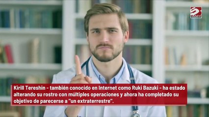 Un soldado ruso se somete a una cirugía plástica para parecer un alien