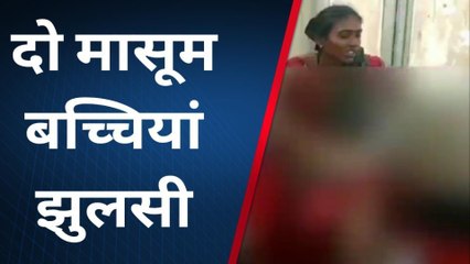 फतेहपुर: जरा सी लापरवाही पड़ी भारी, गर्म जलेबी के सीरा पलटने से दो बच्चियां झुलसी