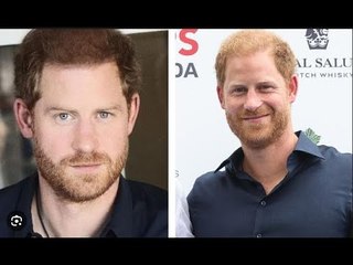 Il principe Harry nella foto con folti riccioli giorni dopo che i capelli erano apparsi più sottili