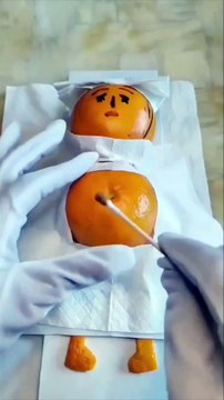 Funny Operation memes Trending going viral | Funny memes | Trending viral