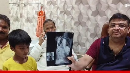 भोजपुर: खेल-खेल के दौरान बच्चे के गले में फंसा सिक्का, किया गया सफल ऑपरेशन