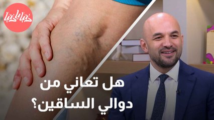 اكتشف كيفية التخلص من دوالي الساقين وتحسين حياتك اليومية