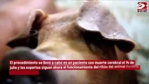 Trasplantan con éxito un riñón de cerdo a un cuerpo humano