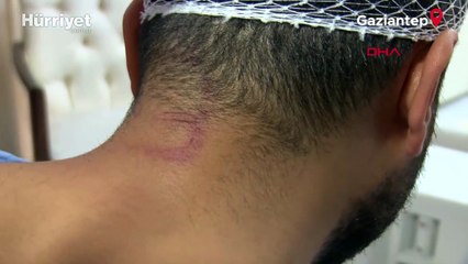 Hasta yakınlarının saldırdığı doktor: Kafamda 15 dikiş var, canımızı zor kurtardık