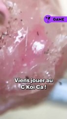 #Ckoica n°10 | Sauras-tu deviner ce qu’on te montre au microscope ? Donne nous ta réponse dans les commentaires ! Indice : ça bouge beaucoup