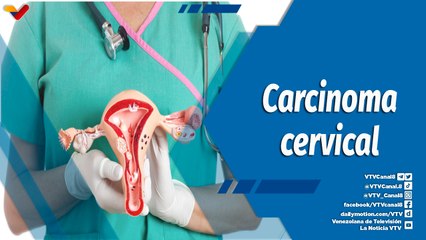 Actitud Saludable | Cáncer de cuello uterino, segunda causa de muerte oncológica en Venezuela