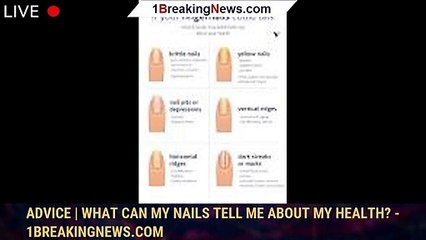 Advice | What can my nails tell me about my health? - 1breakingnews.com