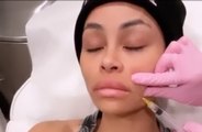 Blac Chyna shocks fans by posting video of her agonising SIXTH facial filler dissolving op