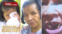 44-anyos na kasambahay, nabulag at nabungi matapos pagmalupitan diumano ng amo | Kapuso Mo, Jessica Soho