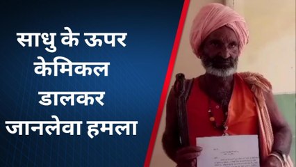 शामली: साधु को जिंदा जलाने की कोशिश, दिमाग में हुआ &#039;केमिकल लोचा&#039;, देखें खबर