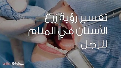 تفسير رؤية زرع الأسنان في المنام للرجل
