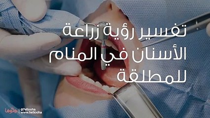 تفسير رؤية زراعة الأسنان في المنام للمطلقة