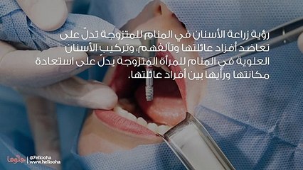 تفسير زراعة الأسنان في المنام للمتزوجة