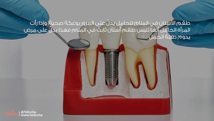 تفسير طقم الأسنان في المنام للحامل