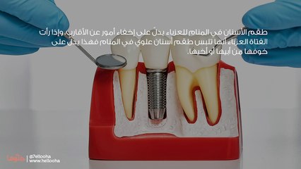 تفسير طقم الأسنان في المنام للعزباء