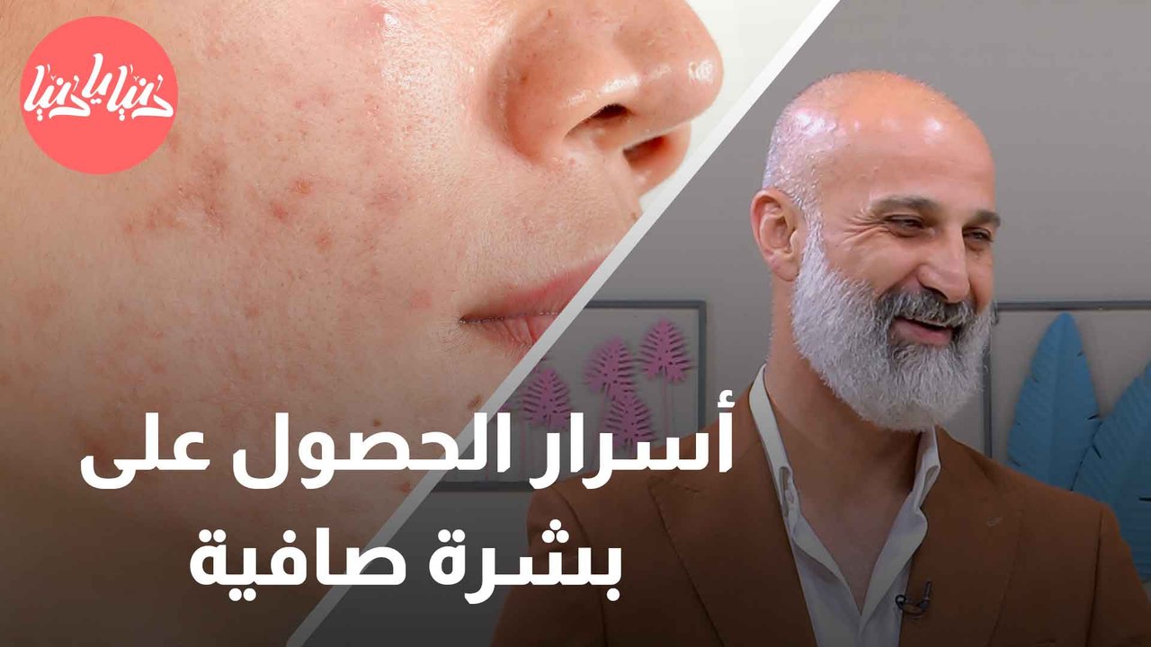 تخلص من آثار حب الشباب بسهولة تجارب ناجحة ونصائح مفيدة