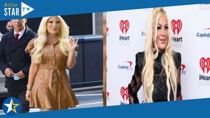 Tori Spelling méconnaissable et le visage tuméfié  les vraies raisons derrière l'hospitalisation de