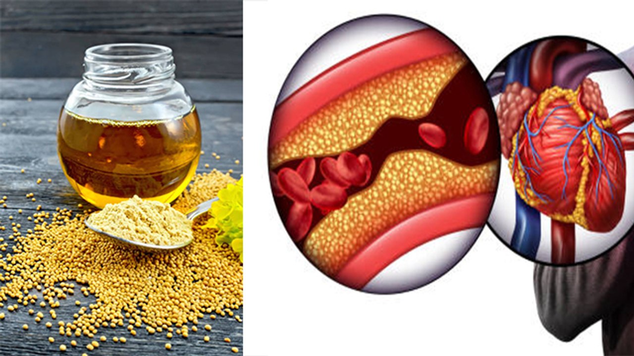 कोलेस्ट्रॉल में सरसों का तेल खाने से क्या होता है Sarson Ke Tel Se
