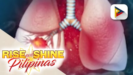 SAY ni DOK | Lung cancer