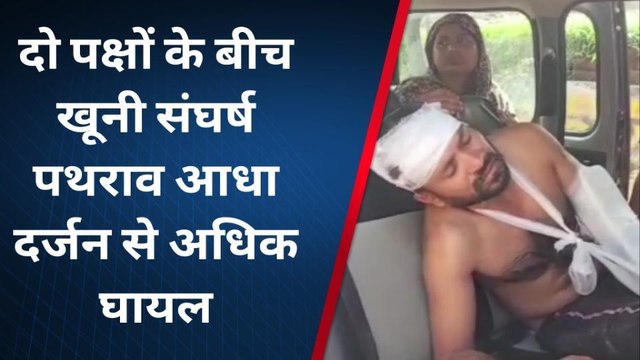 शामली: गांव की गलियों में खेली गई खून की होली, कई लोगों के फूटे सर