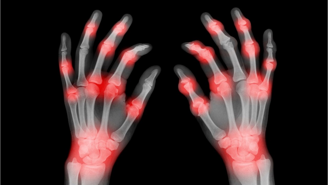 This man's flesh started rotting after being bitten by the UK's most dangerous spider