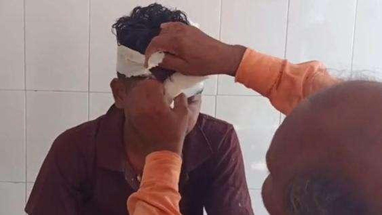 दतिया: मामूली विवाद में युवक पर जानलेवा हमला,गंभीर हालत में अस्पताल में भर्ती