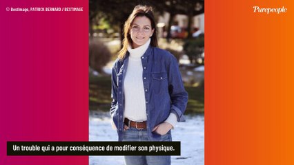 Video herunterladen: Carole Bianic (Demain nous appartient), son physique changé par un trouble : la maladie progresse, une photo dévoilée