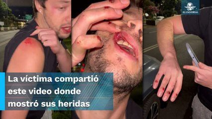 Joven es agredido por presuntos policías de la CDMX tras accidente vehicular