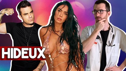 DYSMORPHIE CORPORELLE : LA TERRIBLE MALADIE DE MEGAN FOX & ROBBIE WILLIAMS
