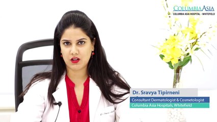 -male-pattern-baldness