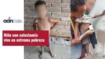 Niño con colostomía vive en extrema pobreza