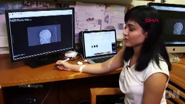 LE SEUL TURC DANS LA RECHERCHE QUI A DÉCORÉ LA MUSIQUE DES ONDES CÉRÉBRALES PARLE AU DHA