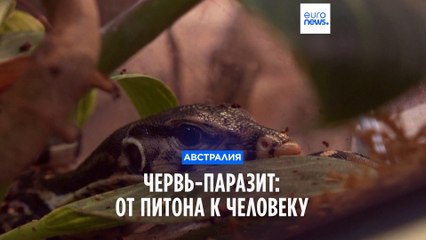 В Австралии в мозгу женщины нашли живого 8-сантиметрового червя