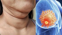 चेहरे पर फैट होना पेट की गंभीर बीमारी का लक्षण | Face Par Fat Kyu Hota Hai | Boldsky