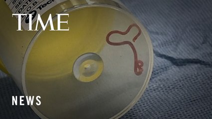 How Australian Doctors Found a 3-Inch-Long Live Worm in a Woman’s Brain