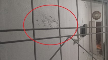 Evinde otururken başından vuruldu