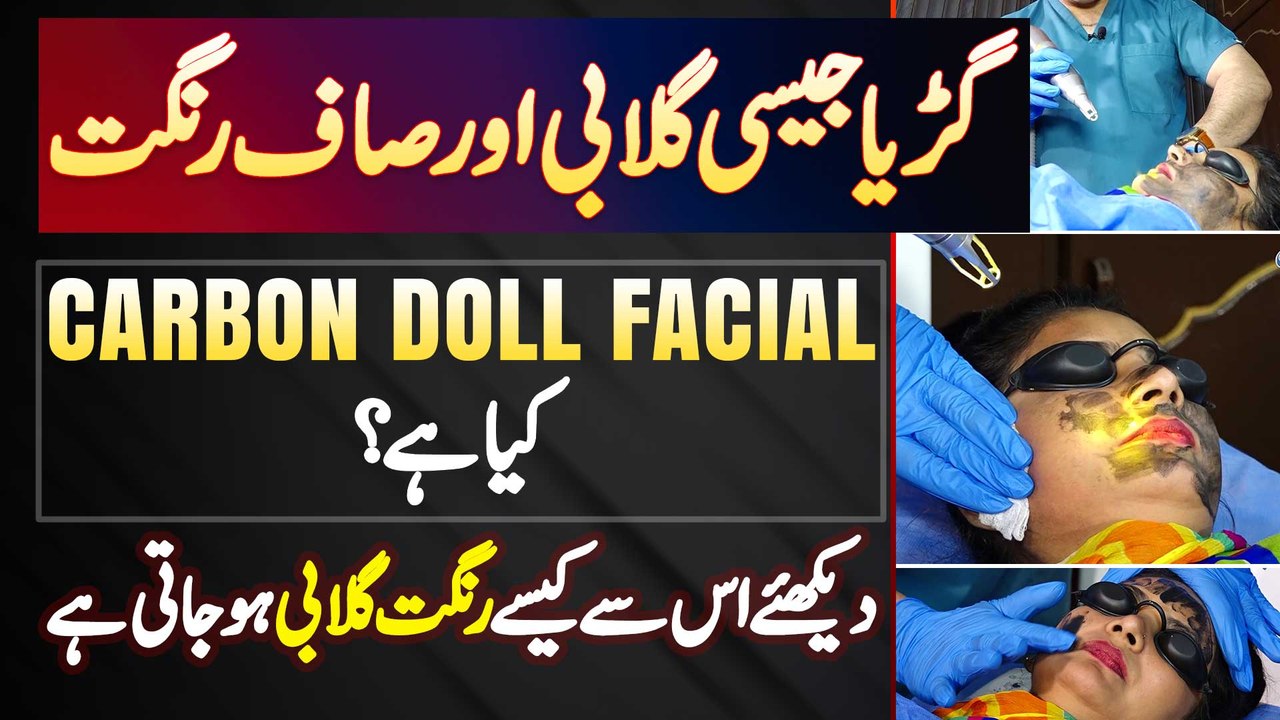 "Carbon Doll Facial" Kia Hai - Guriya Jaise Gulabi Aur Saaf Rangat, Dekhiye Is Ke Kia Benefits Ha?