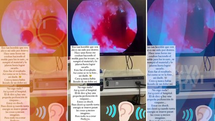 Anahí revela que sigue sin escuchar y su oído no ha sanado