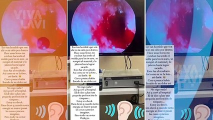 Anahí revela que sigue sin escuchar y su oído no ha sanado