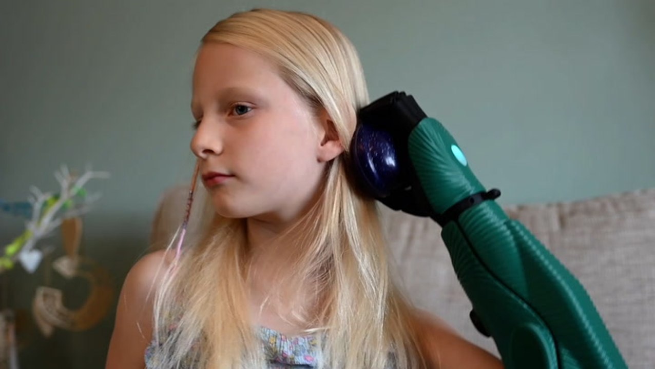 Girl, 7, can now brush her own hair as she beco...