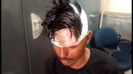 रफ्तार का कहर: बाइक में कार ने मारी टक्कर, बाइक पर सवार तीन लोग हुए घायल
