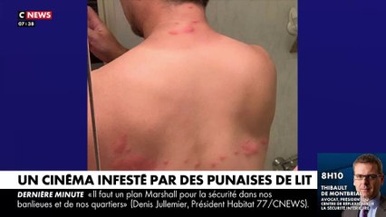 Regardez, en plein Paris, le cinéma UGC Bercy infesté par des centaines de puces de lits qui s'attaquent aux clients à travers les vêtements
