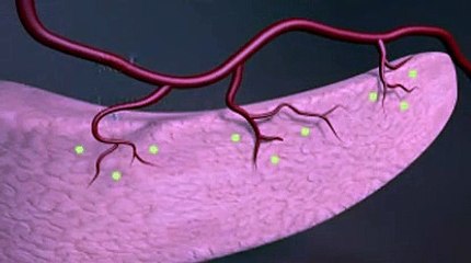 Explosion des cas de diabète en 35 ans, alerte l'OMS