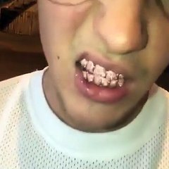 Public Buzz : De nouvelles dents à 15 000 dollars pour Justin Bieber !