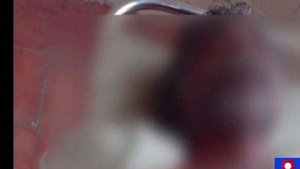 సత్యసాయి జిల్లా: ఇటుకతో దాడి... చిక్సిత పొందుతూ వ్యక్తి మృతి