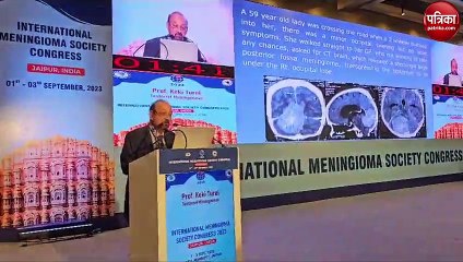 ब्रेन एन्युरिज्म से घबराने की जरूरत नहीं, उपचार संभव