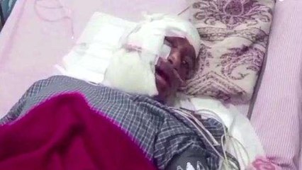 कटनी: बाघ ने बुजुर्ग व्यक्ति पर किया प्राणघातक हमला, घटना के बाद दहशत में लोग